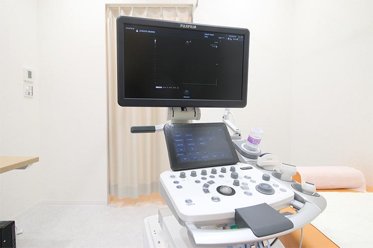 超音波診断装置